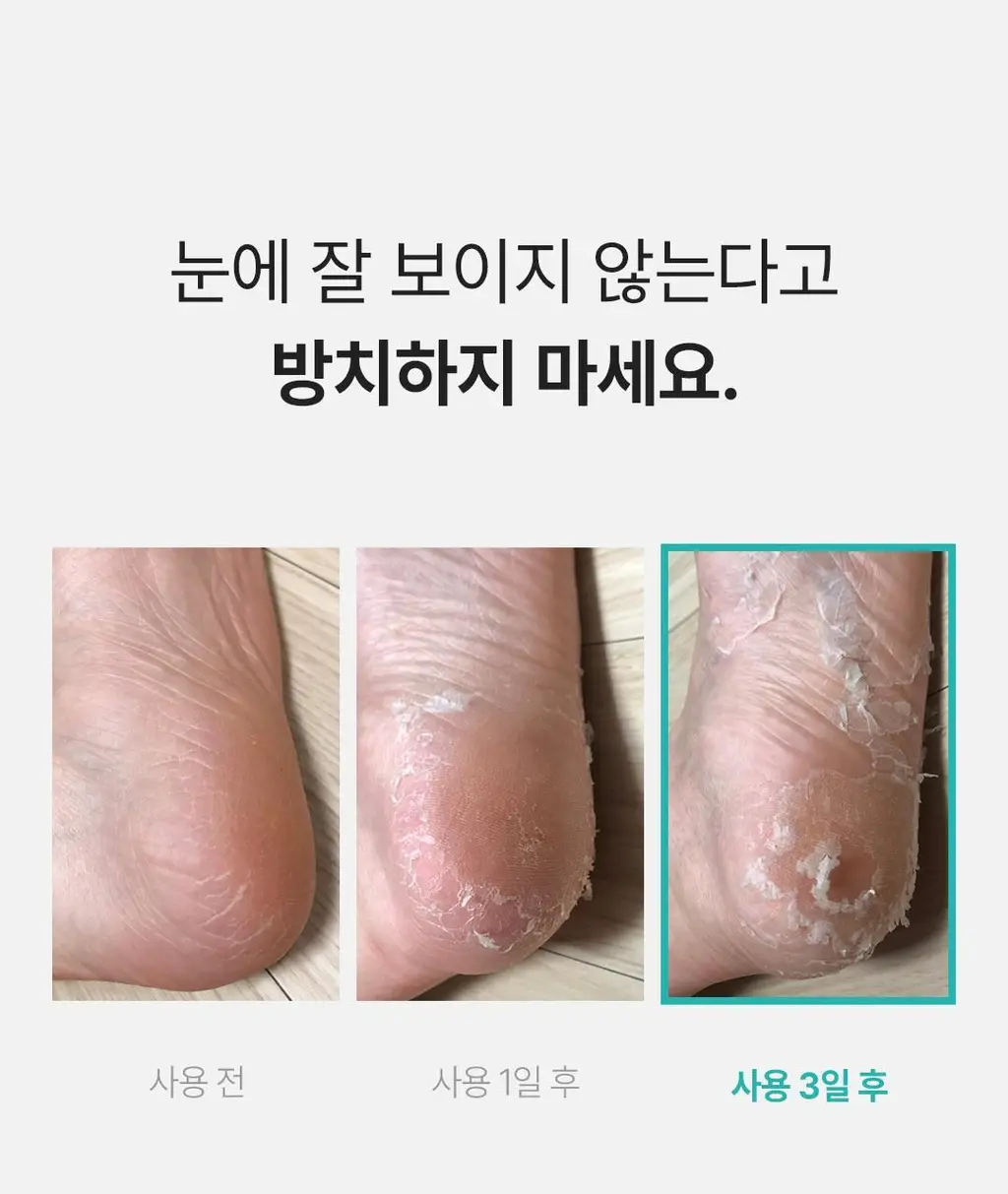 [발허물팩] 아리얼 스무스 앤 퓨어 풋 필링 마스크 2입 7종 택1 상세페이지 13